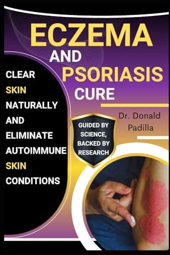 Eczema And Psoriasis Cure: Clear Skin Naturally And Eliminate Autoimmune Skin Conditions