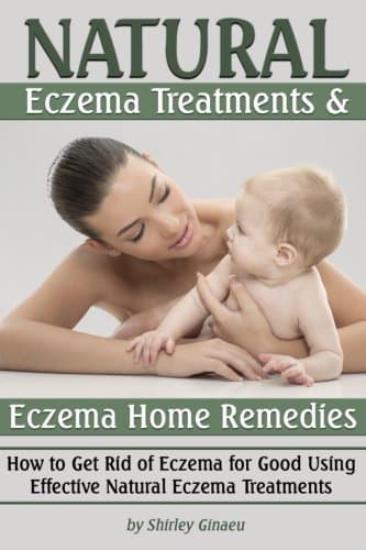 Natural Eczema Treatments and Eczema Home Remedies: How to Get Rid of Eczema for Good Using Effective Natural Eczema Treatments (Natural Remedies for Eczema)